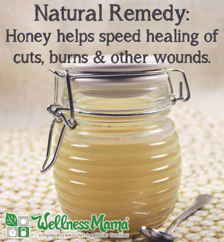 Natural Remedy- Honey helps speed healing of cuts burns and wounds