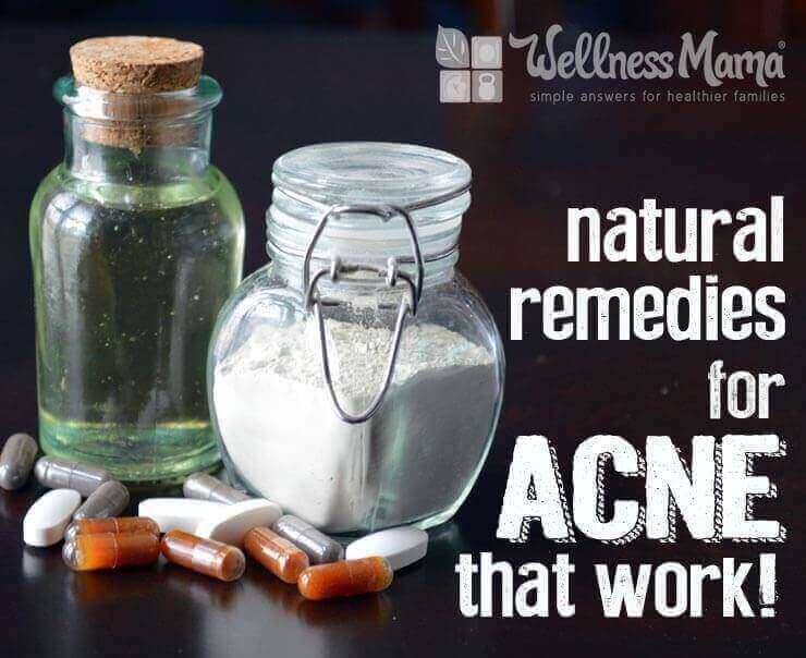 Natural remedies for acne that really work